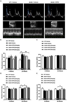 S-Propargyl-Cysteine Attenuates Diabetic Cardiomyopathy in db/db Mice Through Activation of Cardiac Insulin Receptor Signaling